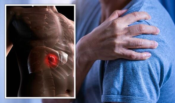 Ung thư gan không chỉ gây đau bụng, đau ở vị trí này cũng có thể là hồi chuông cảnh báo - Ảnh 1. Ung thư gan không chỉ gây đau bụng, đau ở vị trí này cũng có thể là hồi chuông cảnh báo - Ảnh 1.