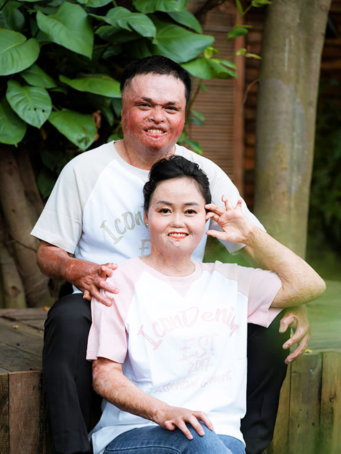 Bị bố đuổi khỏi nhà, chàng trai vẫn quyết cưới cô vợ từng bị chồng cũ tẩm xăng đốt, có 2 con riêng - Ảnh 6. Bị bố đuổi khỏi nhà, chàng trai vẫn quyết cưới cô vợ từng bị chồng cũ tẩm xăng đốt, có 2 con riêng - Ảnh 6.