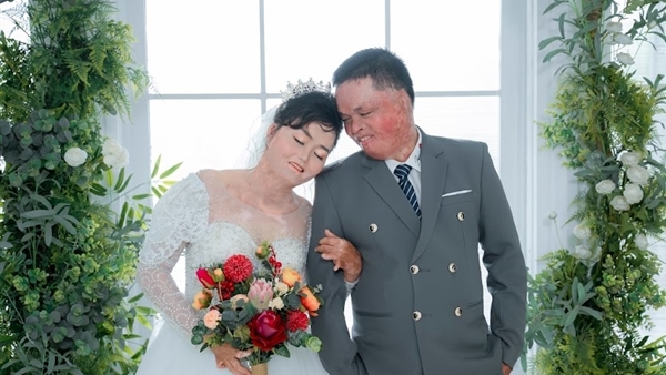 Bị bố đuổi khỏi nhà, chàng trai vẫn quyết cưới cô vợ từng bị chồng cũ tẩm xăng đốt, có 2 con riêng - Ảnh 5. Bị bố đuổi khỏi nhà, chàng trai vẫn quyết cưới cô vợ từng bị chồng cũ tẩm xăng đốt, có 2 con riêng - Ảnh 5.