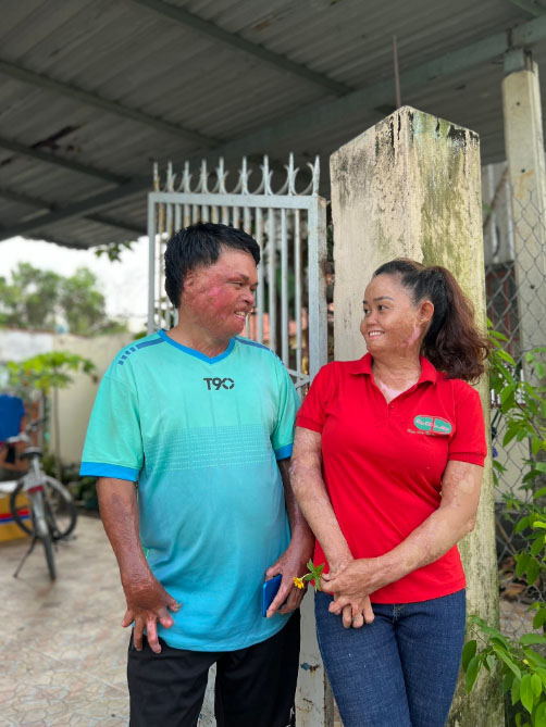 Bị bố đuổi khỏi nhà, chàng trai vẫn quyết cưới cô vợ từng bị chồng cũ tẩm xăng đốt, có 2 con riêng - Ảnh 3. Bị bố đuổi khỏi nhà, chàng trai vẫn quyết cưới cô vợ từng bị chồng cũ tẩm xăng đốt, có 2 con riêng - Ảnh 3.