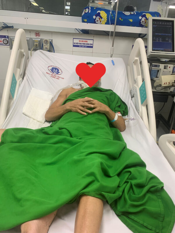 Giẫm phải chiếc đinh nhỏ, người đàn ông phải thở máy gần 1 tháng: Bác sĩ cảnh báo - Ảnh 1. Giẫm phải chiếc đinh nhỏ, người đàn ông phải thở máy gần 1 tháng: Bác sĩ cảnh báo - Ảnh 1.