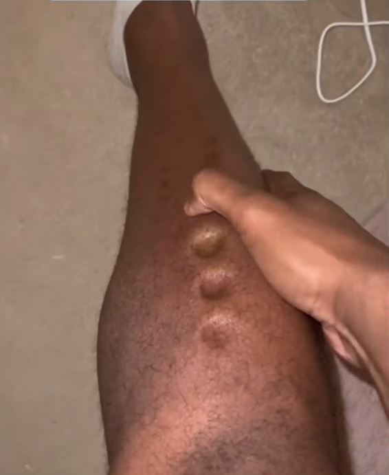 Bác sĩ cấp cứu: Ấn vào chân mà thấy hiện tượng này thì rất có thể tim, gan, thận đang 'kêu cứu'- Ảnh 1. Bác sĩ cấp cứu: Ấn vào chân mà thấy hiện tượng này thì rất có thể tim, gan, thận đang 'kêu cứu'- Ảnh 1.