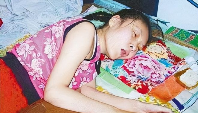 Bị anh trai tát 2 phát, cô gái giả vờ bại liệt gần 20 năm, sự thật được vạch trần nhờ chi tiết lạ- Ảnh 3. Bị anh trai tát 2 phát, cô gái giả vờ bại liệt gần 20 năm, sự thật được vạch trần nhờ chi tiết lạ- Ảnh 3.