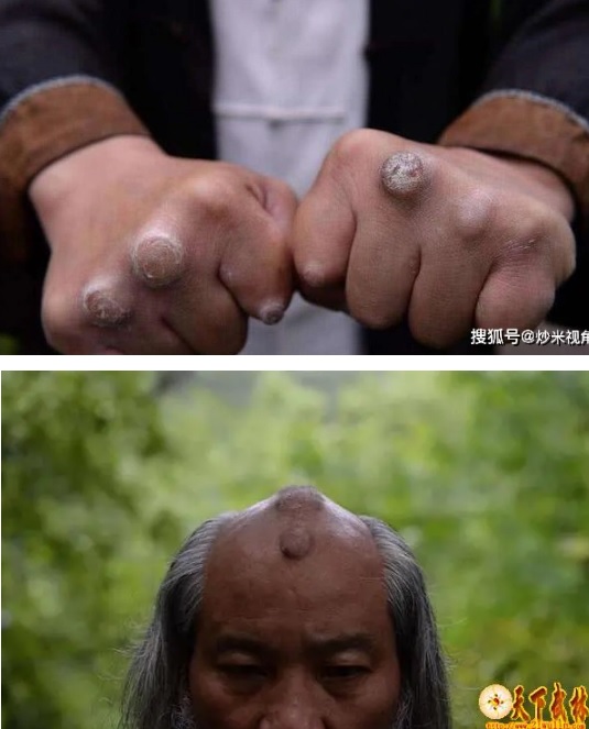 Cao thủ “đệ nhất ngạnh công Trung Quốc” thi triển tuyệt kỹ “Tam Hoa Tụ Đỉnh” theo cách lạ- Ảnh 2. Cao thủ “đệ nhất ngạnh công Trung Quốc” thi triển tuyệt kỹ “Tam Hoa Tụ Đỉnh” theo cách lạ- Ảnh 2.