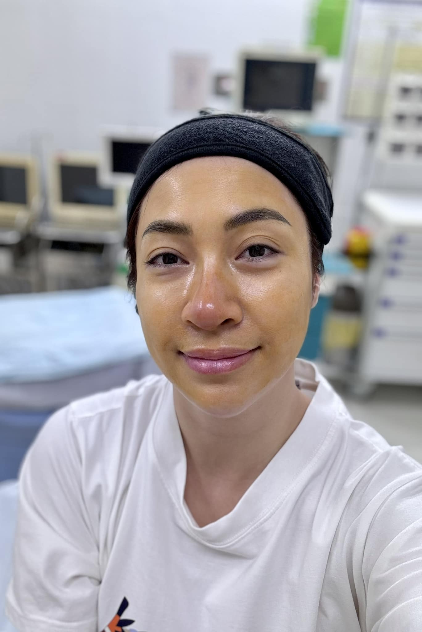 Ca sĩ Việt thông báo mũi viêm nặng sau 12 năm dao kéo, đi bác sĩ không dám gây mê dù Ca sĩ Việt thông báo mũi viêm nặng sau 12 năm dao kéo, đi bác sĩ không dám gây mê dù