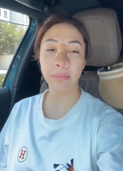 Ca sĩ Việt thông báo mũi viêm nặng sau 12 năm dao kéo, đi bác sĩ không dám gây mê dù Ca sĩ Việt thông báo mũi viêm nặng sau 12 năm dao kéo, đi bác sĩ không dám gây mê dù