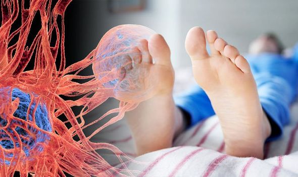 Giơ chân lên mà thấy 6 dấu hiệu này, hãy cảnh giác với ung thư- Ảnh 1. Giơ chân lên mà thấy 6 dấu hiệu này, hãy cảnh giác với ung thư- Ảnh 1.