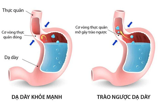 &quot;X-quang&quot; cơ thể nhìn thấu những điều lạ sẽ xảy ra khi ăn no &quot;vỡ bụng&quot;: Dạ dày đang như quả nho khô dần phình to chèn ép cơ quan nội tạng - Ảnh 3.