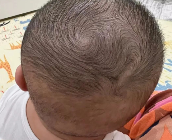 Thấy con có 2 xoáy tóc trên đầu, nhiều bố mẹ vui mừng tột độ: Sự thật đằng sau lại gây hụt hẫng - Ảnh 3. Thấy con có 2 xoáy tóc trên đầu, nhiều bố mẹ vui mừng tột độ: Sự thật đằng sau lại gây hụt hẫng - Ảnh 3.