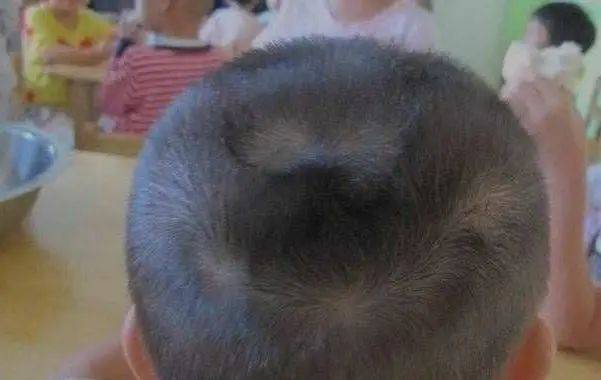 Thấy con có 2 xoáy tóc trên đầu, nhiều bố mẹ vui mừng tột độ: Sự thật đằng sau lại gây hụt hẫng - Ảnh 5. Thấy con có 2 xoáy tóc trên đầu, nhiều bố mẹ vui mừng tột độ: Sự thật đằng sau lại gây hụt hẫng - Ảnh 5.