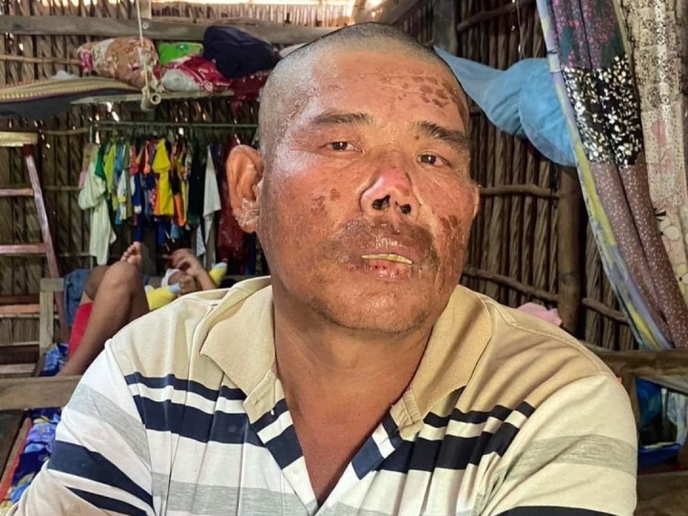 Sau 4 ngày đêm trôi nổi trên biển, bị cá rỉa thịt, người đàn ông sống sót trở về, số phận thay đổi 180 độ - Ảnh 1.