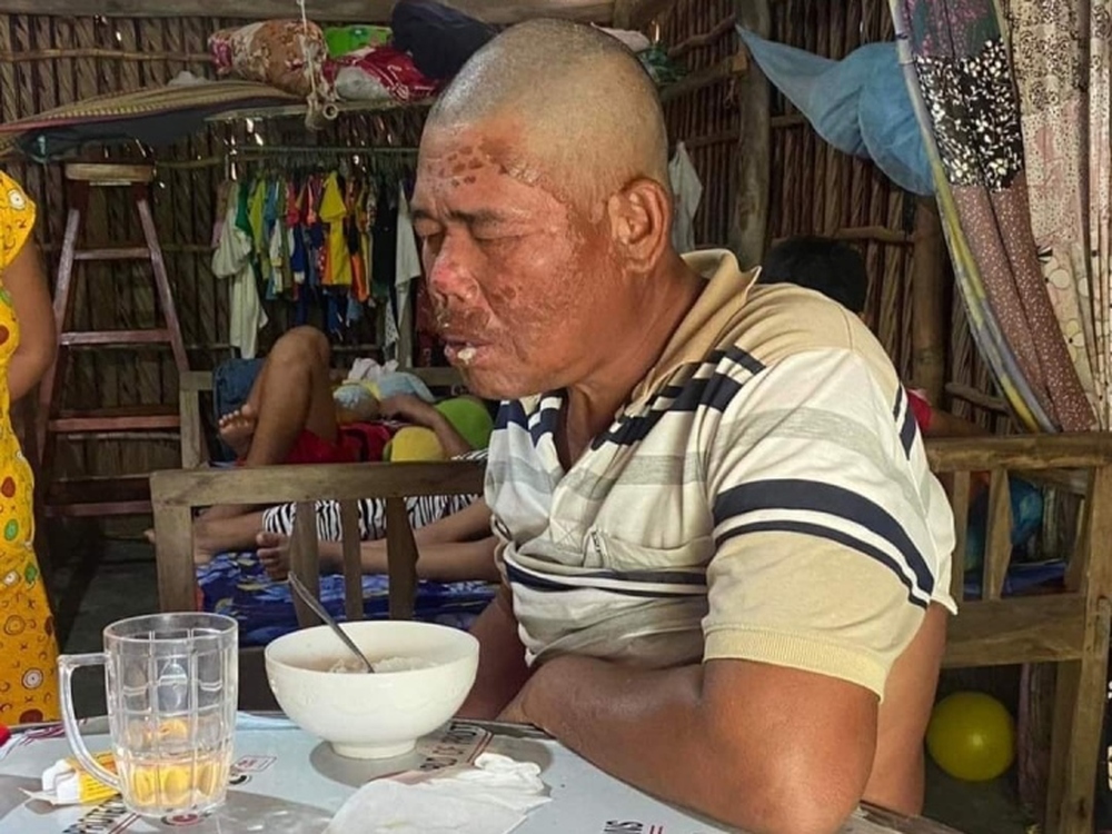 Sau 4 ngày đêm trôi nổi trên biển, bị cá rỉa thịt, người đàn ông sống sót trở về, số phận thay đổi 180 độ - Ảnh 2.