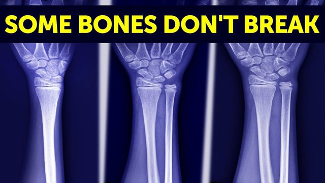 Các nhà khoa học đã phát hiện ra gen siêu năng lực, và những 'siêu nhân' có khả năng sẽ trở thành hiện thực trong tương lai!- Ảnh 3. Các nhà khoa học đã phát hiện ra gen siêu năng lực, và những 'siêu nhân' có khả năng sẽ trở thành hiện thực trong tương lai!- Ảnh 3.