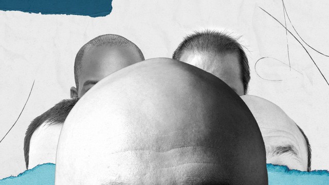 Tại sao đàn ông thường hói đầu còn phụ nữ thì hiếm khi?- Ảnh 1. Tại sao đàn ông thường hói đầu còn phụ nữ thì hiếm khi?- Ảnh 1.