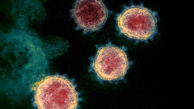 Con người truyền số lượng virus sang động vật nhiều gấp đôi số lượng chúng ta lây từ chúng!- Ảnh 6. Con người truyền số lượng virus sang động vật nhiều gấp đôi số lượng chúng ta lây từ chúng!- Ảnh 6.