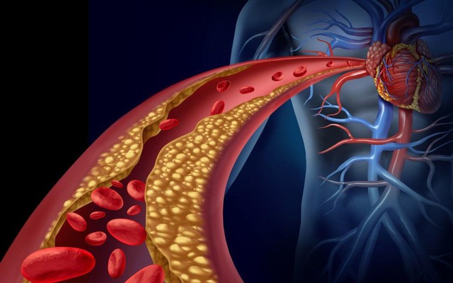 Ăn trứng có làm tăng cholesterol như lời đồn? Câu trả lời bất ngờ từ bác sĩ tim mạch- Ảnh 1.