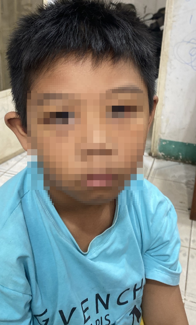 Vụ cha dượng đánh con riêng của vợ cũ: Người mẹ phản ứng thế nào khi con bị đánh?- Ảnh 1. Vụ cha dượng đánh con riêng của vợ cũ: Người mẹ phản ứng thế nào khi con bị đánh?- Ảnh 1.