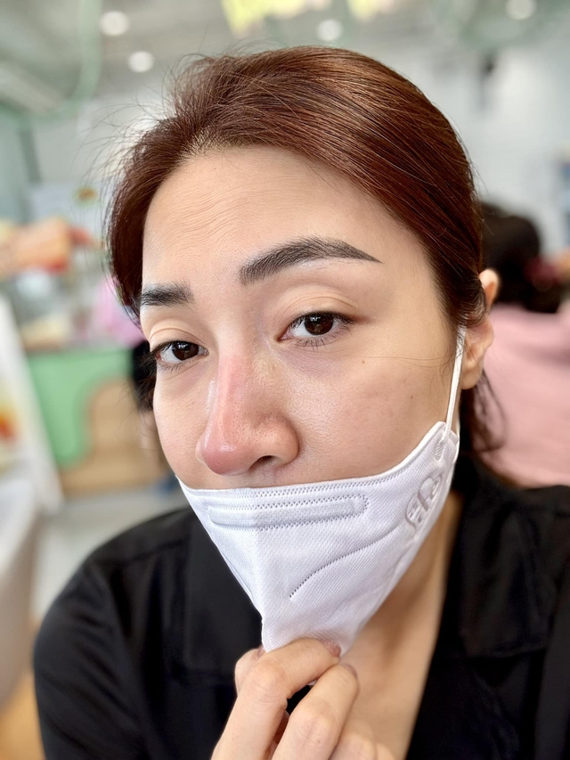 Ca sĩ Việt thông báo mũi viêm nặng sau 12 năm dao kéo, đi bác sĩ không dám gây mê dù Ca sĩ Việt thông báo mũi viêm nặng sau 12 năm dao kéo, đi bác sĩ không dám gây mê dù