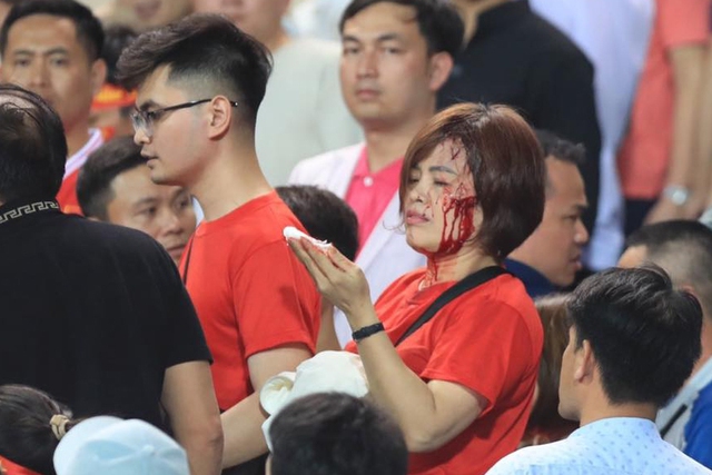 CĐV Việt Nam bị đánh chảy máu đầu ngay tại sân Mỹ Đình trong ngày đội nhà thua Indonesia- Ảnh 3. CĐV Việt Nam bị đánh chảy máu đầu ngay tại sân Mỹ Đình trong ngày đội nhà thua Indonesia- Ảnh 3.