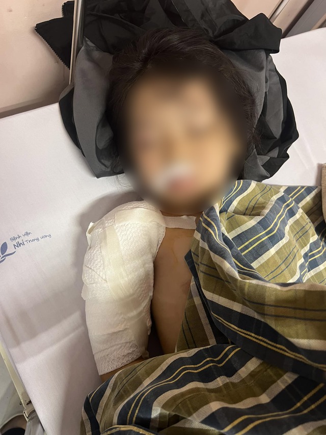 Vụ bé gái 5 tuổi ở Hà Giang bị chó cắn nhập viện: Con chó có nhiều Vụ bé gái 5 tuổi ở Hà Giang bị chó cắn nhập viện: Con chó có nhiều