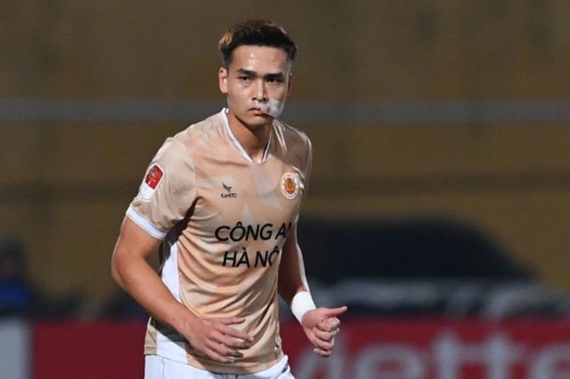 Trung vệ tuyển Việt Nam lên xe cấp cứu, nhập viện gấp sau pha va chạm tại V.League- Ảnh 2. Trung vệ tuyển Việt Nam lên xe cấp cứu, nhập viện gấp sau pha va chạm tại V.League- Ảnh 2.