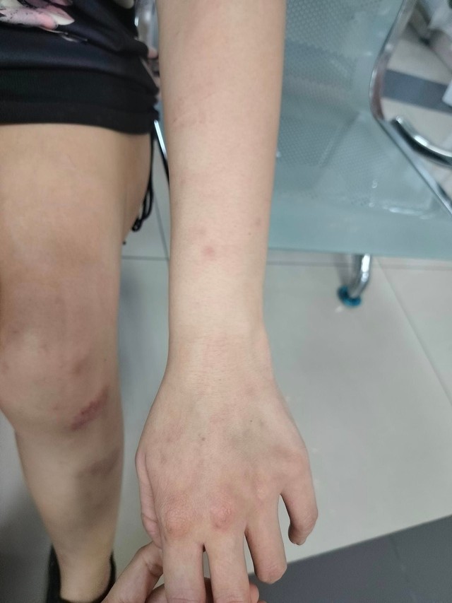 Bị chồng bạo hành dã man, vợ gọi người yêu cũ tới ứng cứu và cái kết 