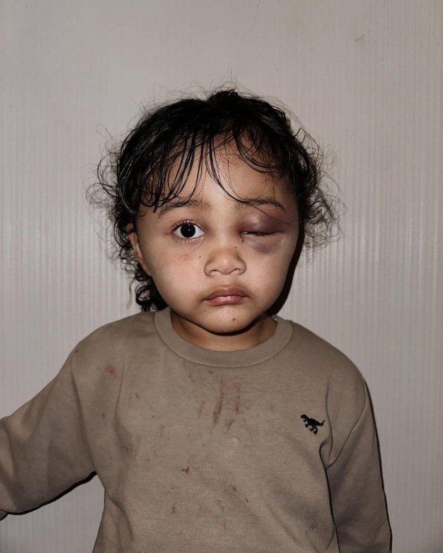 Hành hạ dã man bé gái, bảo mẫu bị bố mẹ nạn nhân hỏi tội liền có biểu hiện khó đỡ: Hút 3 triệu lượt xem- Ảnh 1. Hành hạ dã man bé gái, bảo mẫu bị bố mẹ nạn nhân hỏi tội liền có biểu hiện khó đỡ: Hút 3 triệu lượt xem- Ảnh 1.