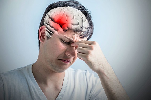 Người đàn ông suýt chết sau một cơn đau đầu: BS cảnh báo người có 1 trong 7 đặc điểm này cần cẩn trọng- Ảnh 3. Người đàn ông suýt chết sau một cơn đau đầu: BS cảnh báo người có 1 trong 7 đặc điểm này cần cẩn trọng- Ảnh 3.