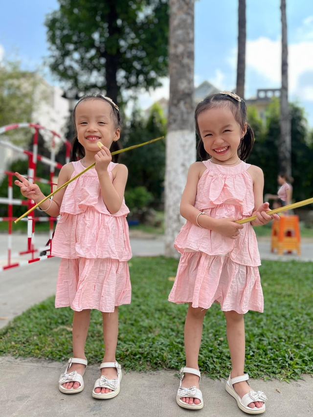 4 năm sau ca phẫu thuật tách rời của cặp sinh đôi dính liền: Trúc Nhi vẫn còn vấn đề khiến bố mẹ trăn trở- Ảnh 3. 4 năm sau ca phẫu thuật tách rời của cặp sinh đôi dính liền: Trúc Nhi vẫn còn vấn đề khiến bố mẹ trăn trở- Ảnh 3.