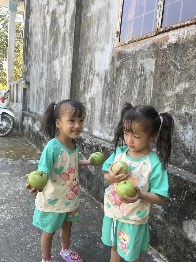 4 năm sau ca phẫu thuật tách rời của cặp sinh đôi dính liền: Trúc Nhi vẫn còn vấn đề khiến bố mẹ trăn trở- Ảnh 2. 4 năm sau ca phẫu thuật tách rời của cặp sinh đôi dính liền: Trúc Nhi vẫn còn vấn đề khiến bố mẹ trăn trở- Ảnh 2.