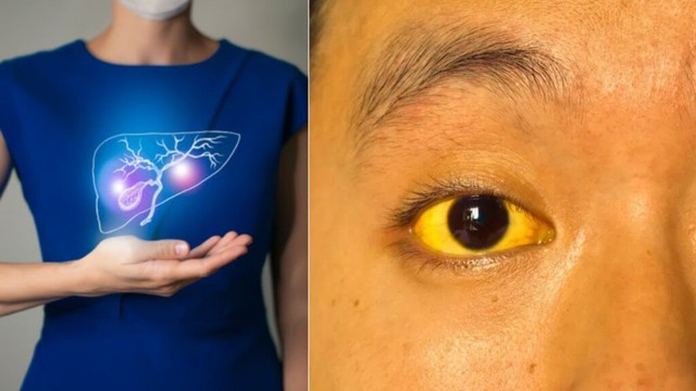 Người “đoản thọ” thường có 5 đặc điểm trên khuôn mặt: Nếu không có tất cả chứng tỏ cơ thể vẫn khỏe mạnh- Ảnh 1. Người “đoản thọ” thường có 5 đặc điểm trên khuôn mặt: Nếu không có tất cả chứng tỏ cơ thể vẫn khỏe mạnh- Ảnh 1.