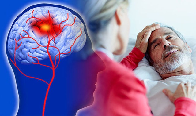 Người đàn ông 53 tuổi liệt nửa người, đột quỵ não giữa đêm: BS chỉ ra ngay 2 thói quen làm tăng nguy cơ- Ảnh 1. Người đàn ông 53 tuổi liệt nửa người, đột quỵ não giữa đêm: BS chỉ ra ngay 2 thói quen làm tăng nguy cơ- Ảnh 1.
