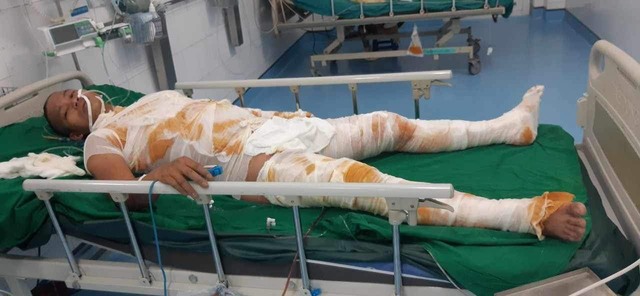 Nam thanh niên 33 tuổi suy thận cấp, nguy kịch tính mạng, anh trai cầu cứu sự giúp đỡ- Ảnh 1. Nam thanh niên 33 tuổi suy thận cấp, nguy kịch tính mạng, anh trai cầu cứu sự giúp đỡ- Ảnh 1.