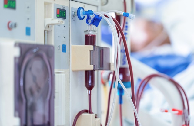 Liên tiếp điều trị cho 3 bệnh nhân suy hỏng thận, bác sĩ thốt lên: “Tất cả đều có 1 điểm chung”- Ảnh 1. Liên tiếp điều trị cho 3 bệnh nhân suy hỏng thận, bác sĩ thốt lên: “Tất cả đều có 1 điểm chung”- Ảnh 1.