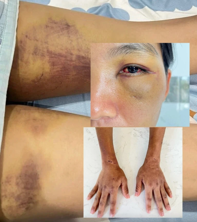 Vụ nhà chồng bạo hành, gọi con dâu là "yêu quái đầu thai": 5 cháu nhỏ được "giải cứu" thành công- Ảnh 2. Vụ nhà chồng bạo hành, gọi con dâu là "yêu quái đầu thai": 5 cháu nhỏ được "giải cứu" thành công- Ảnh 2.