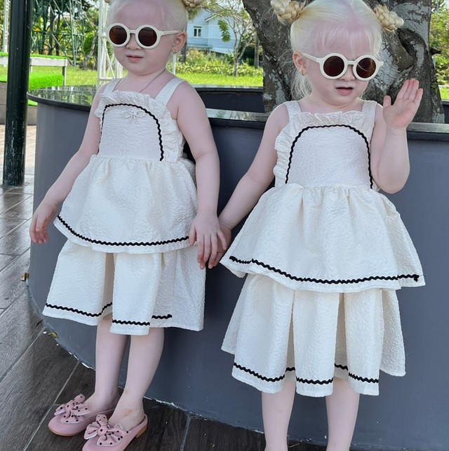 Cặp song sinh "kỳ lạ" ở Sóc Trăng sau 2 năm nổi tiếng, gia đình từ ở trọ đã xây được nhà riêng- Ảnh 2. Cặp song sinh "kỳ lạ" ở Sóc Trăng sau 2 năm nổi tiếng, gia đình từ ở trọ đã xây được nhà riêng- Ảnh 2.