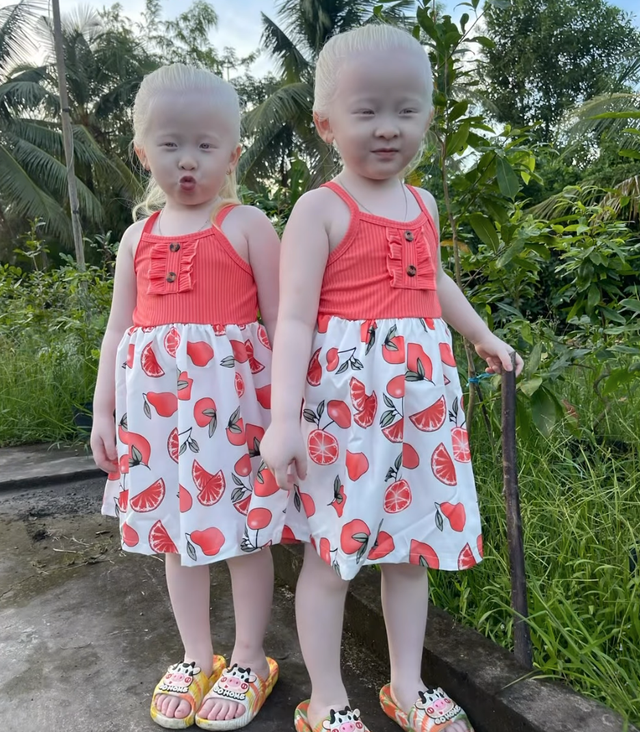 Cặp song sinh "kỳ lạ" ở Sóc Trăng sau 2 năm nổi tiếng, gia đình từ ở trọ đã xây được nhà riêng- Ảnh 3. Cặp song sinh "kỳ lạ" ở Sóc Trăng sau 2 năm nổi tiếng, gia đình từ ở trọ đã xây được nhà riêng- Ảnh 3.