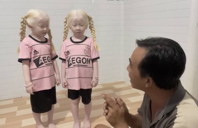 Cặp song sinh "kỳ lạ" ở Sóc Trăng sau 2 năm nổi tiếng, gia đình từ ở trọ đã xây được nhà riêng- Ảnh 5. Cặp song sinh "kỳ lạ" ở Sóc Trăng sau 2 năm nổi tiếng, gia đình từ ở trọ đã xây được nhà riêng- Ảnh 5.