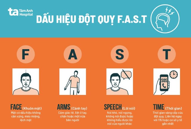 Đột quỵ tăng cao trong mùa lạnh, bác sỹ hướng dẫn 4 quy tắc nhận biết để kịp cấp cứu ngay trong giờ vàng - Ảnh 3.