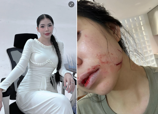 Nhìn từ vụ Hằng Du Mục tố chồng đánh đập: 7,4 giây có một phụ nữ bị bạo hành gia đình nhưng phải bị ngược đãi ít nhất 35 lần thì nạn nhân mới báo cảnh sát- Ảnh 1. Nhìn từ vụ Hằng Du Mục tố chồng đánh đập: 7,4 giây có một phụ nữ bị bạo hành gia đình nhưng phải bị ngược đãi ít nhất 35 lần thì nạn nhân mới báo cảnh sát- Ảnh 1.