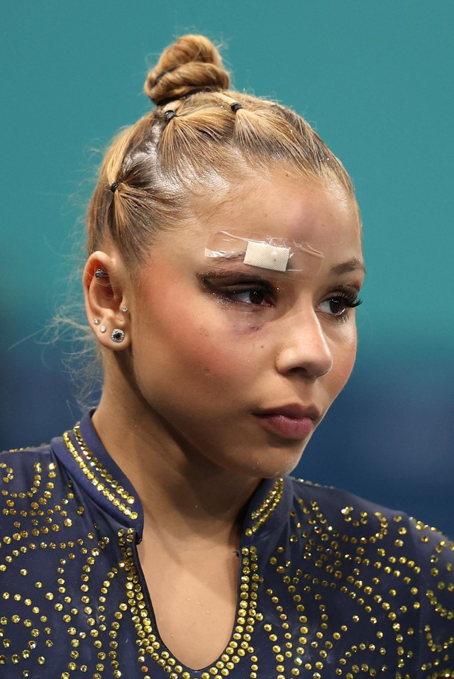 Olympic Paris 2024: Nữ VĐV TDDC đổ máu sau cú ngã kinh hoàng, nam cua-rơ nhập viện vì chấn thương đáng sợ- Ảnh 3. Olympic Paris 2024: Nữ VĐV TDDC đổ máu sau cú ngã kinh hoàng, nam cua-rơ nhập viện vì chấn thương đáng sợ- Ảnh 3.