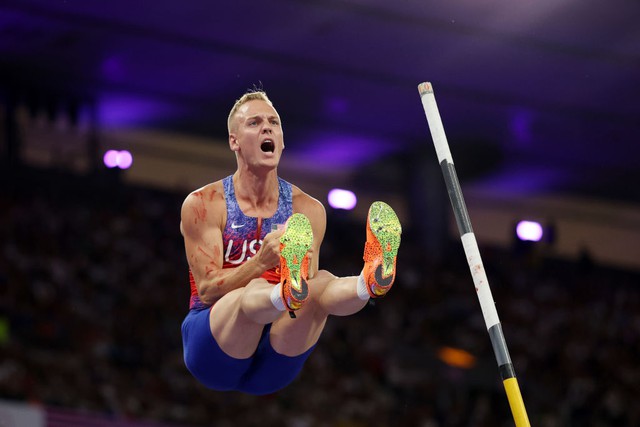 VĐV nhảy sào Olympic gây choáng với hình ảnh bê bết máu, thi đấu vẫn giành huy chương- Ảnh 2. VĐV nhảy sào Olympic gây choáng với hình ảnh bê bết máu, thi đấu vẫn giành huy chương- Ảnh 2.