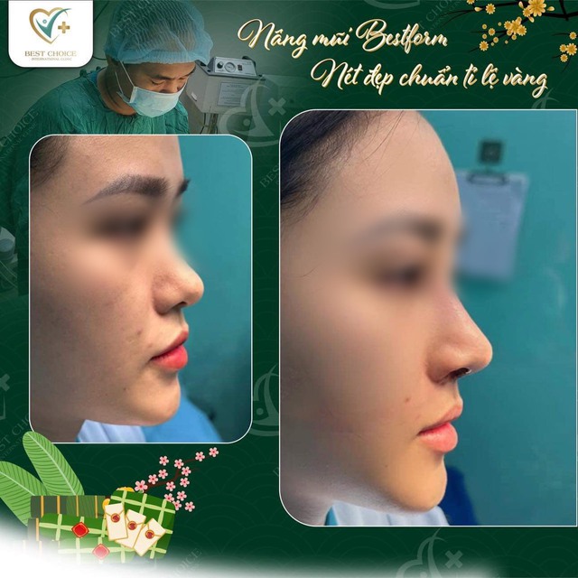 Dr Tuấn Nguyễn: “Khách hàng tìm đến tôi vì muốn đổi phong thủy gương mặt”- Ảnh 3.