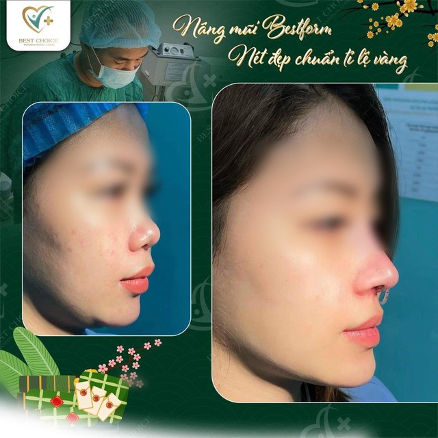 Dr Tuấn Nguyễn: “Khách hàng tìm đến tôi vì muốn đổi phong thủy gương mặt”- Ảnh 2. Dr Tuấn Nguyễn: “Khách hàng tìm đến tôi vì muốn đổi phong thủy gương mặt”- Ảnh 2.