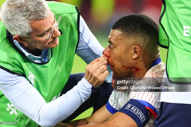 Mbappe chảy máu đầm đìa, đội tuyển Pháp không cần ghi bàn nhưng vẫn thắng- Ảnh 3. Mbappe chảy máu đầm đìa, đội tuyển Pháp không cần ghi bàn nhưng vẫn thắng- Ảnh 3.