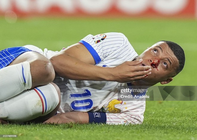 Mbappe chảy máu đầm đìa, đội tuyển Pháp không cần ghi bàn nhưng vẫn thắng- Ảnh 4. Mbappe chảy máu đầm đìa, đội tuyển Pháp không cần ghi bàn nhưng vẫn thắng- Ảnh 4.