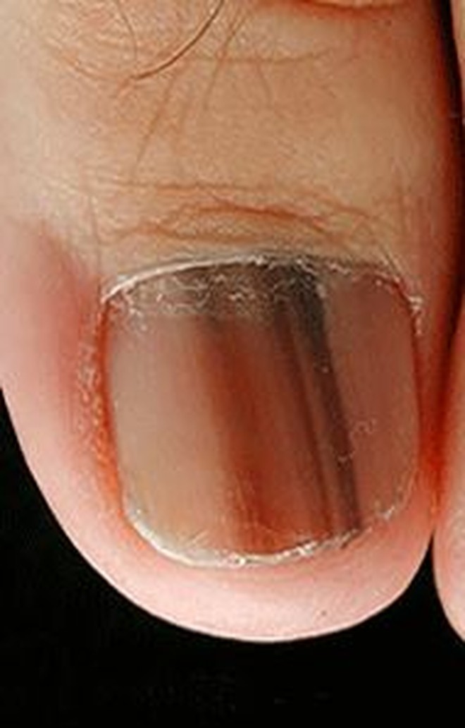 Giơ chân lên mà thấy 6 dấu hiệu này, hãy cảnh giác với ung thư- Ảnh 2. Giơ chân lên mà thấy 6 dấu hiệu này, hãy cảnh giác với ung thư- Ảnh 2.