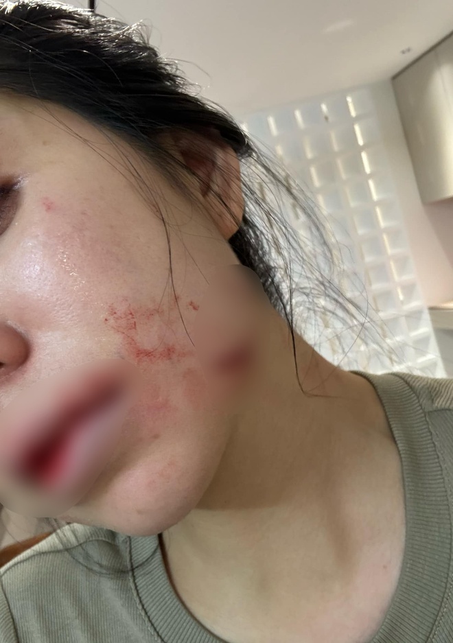 Nóng: Hằng Du Mục công khai toàn bộ hình ảnh bị chồng bạo hành tàn nhẫn, tuyên bố thời điểm ly hôn- Ảnh 2. Nóng: Hằng Du Mục công khai toàn bộ hình ảnh bị chồng bạo hành tàn nhẫn, tuyên bố thời điểm ly hôn- Ảnh 2.