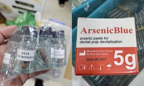 Từ vụ triệt phá đường dây sản xuất thạch tín dùng trong nha khoa: Hiểm họa từ những 