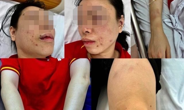 Vụ người phụ nữ ở Hà Nội tố bị chồng cũ hành hung gần 1 ngày: Hung thủ trình diện, khai nhận hành vi